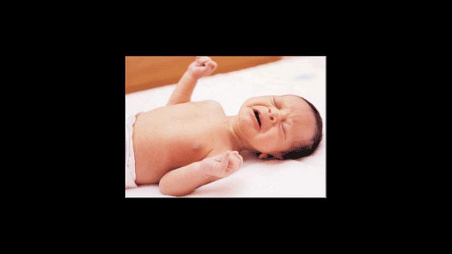 Convulsiones en el niño: Aprende a atenderlas para evitar consecuencias Convulsiones en el niño: Aprende a atenderlas para evitar consecuencias