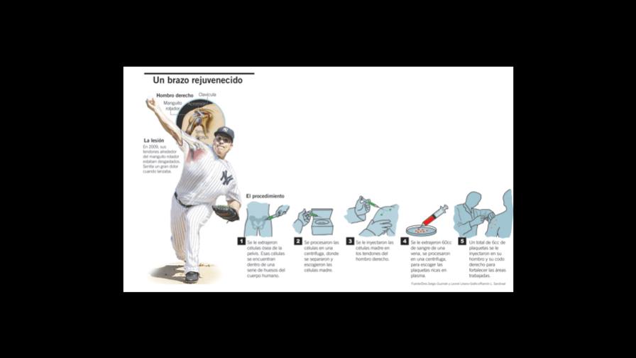Stem cells give life to the arm of Bartolo Colon