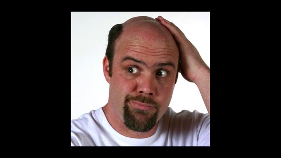 Medicina contra la calvicie podría afectar vigor sexual