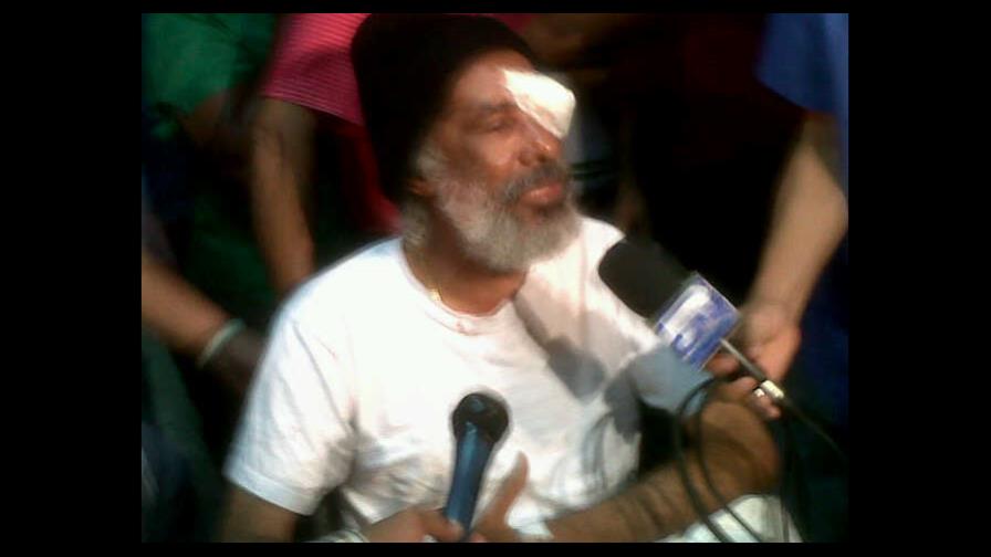 Agentes de la PN hieren al diputado Juan Hubieres Agentes de la PN hieren al diputado Juan Hubieres