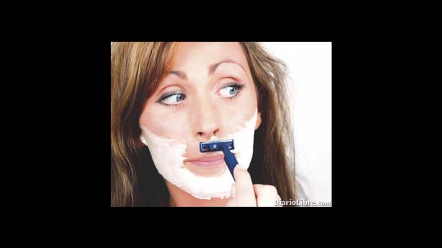 Hirsutismo Hirsutismo