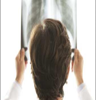 Educar sobre Hipertensión Pulmonar