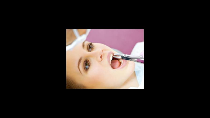 Fracturas Dentarias: ¿Por qué se rompen los dientes?