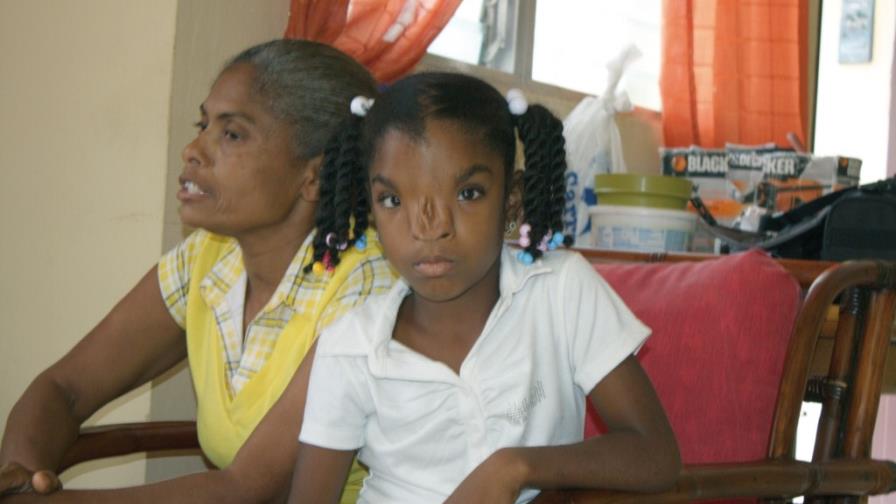 Buscan ayuda operar niña hipertelorismo