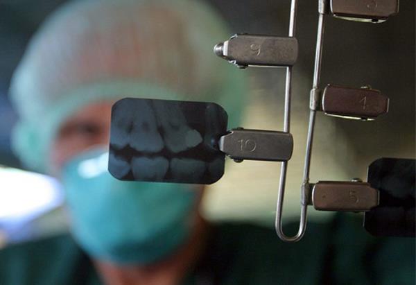 Instituciones anuncian implantes dentales gratuitos