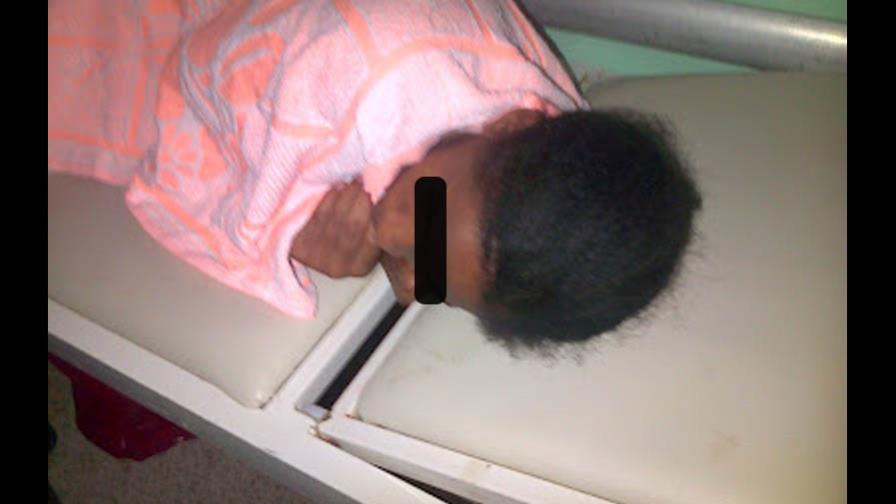 Hombre rocía con “ácido del diablo” la vagina de una menor de 16 años