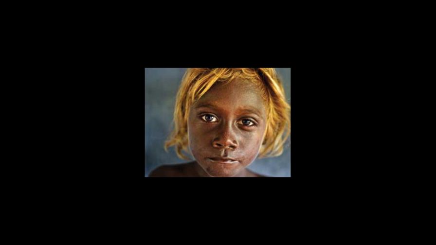 Un gen único, el secreto del cabello rubio en las Islas Salomón