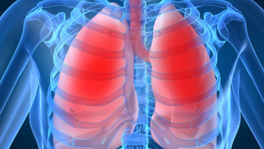 Estudio identifica diversos tipos de pacientes de enfermedad pulmonar crónica