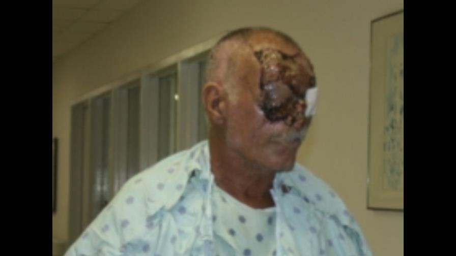 La víctima del caníbal de Miami revela los detalles del ataque