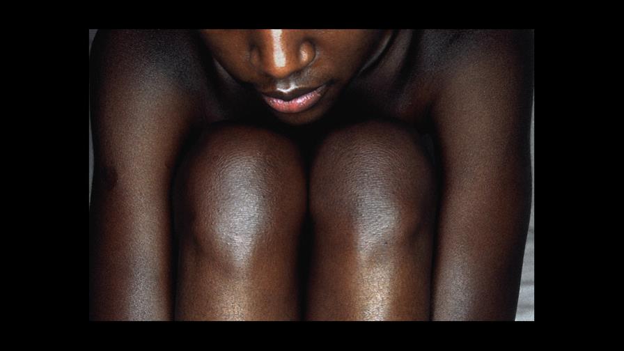 Estudio: Mujeres negras tienen más dificultades para eliminar VPH