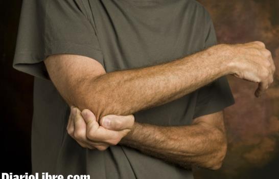 Una dieta adecuada puede prevenir o aliviar la artritis reumatoide