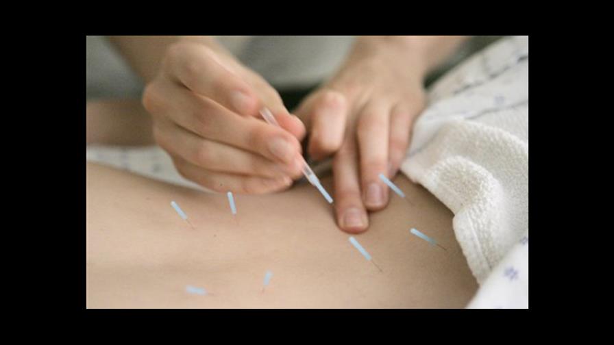 Estudio confirma que la acupuntura sí ayuda contra el dolor