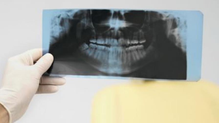 ¿Para qué sirven las muelas del juicio?