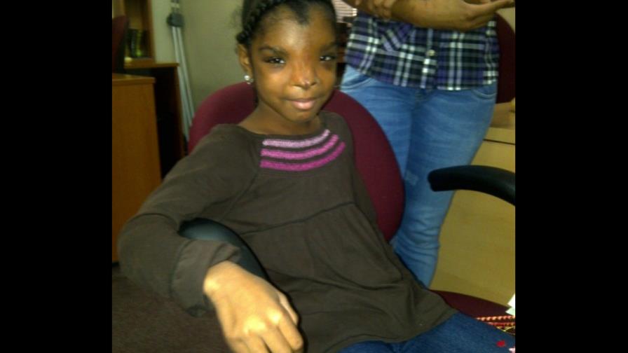 Niña operada de hipertelorismo agradece apoyo de DL