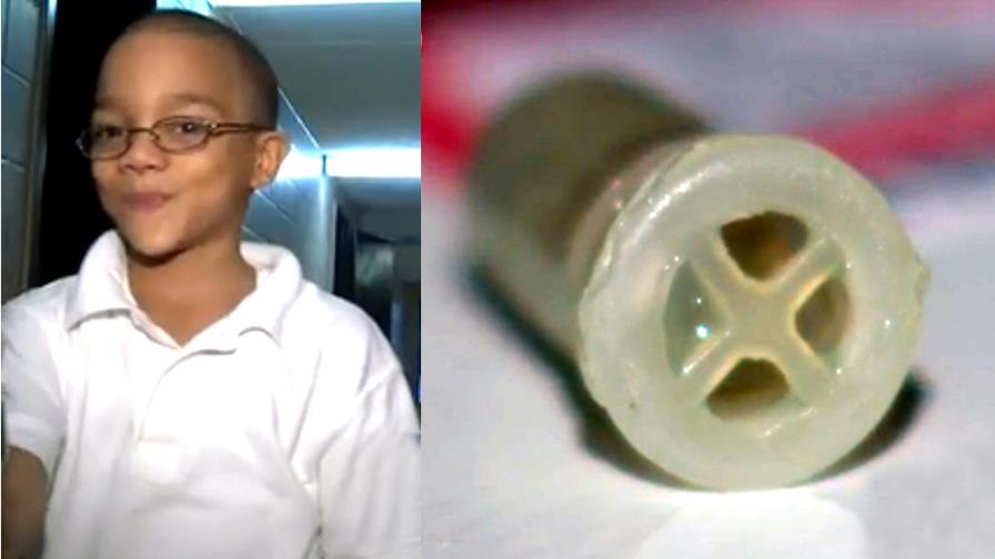 Niño dominicano se traga pito de un juguete y se salva de milagro Niño dominicano se traga pito de un juguete y se salva de milagro