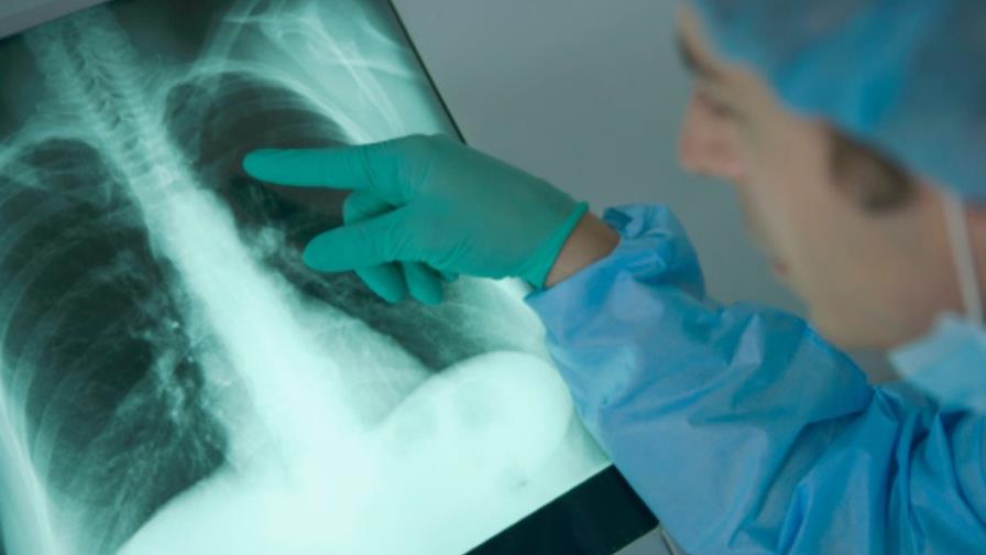 Cuídese del riesgo de tromboembolia pulmonar durante las cirugías estéticas