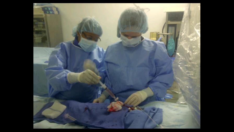 Convocan a jornada de valvuloplastía mitral