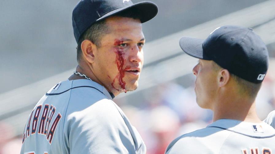 Miguel Cabrera, pelotazo en la cara Miguel Cabrera, pelotazo en la cara