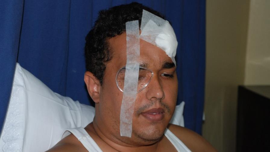 Empleado de UASD podría perder visión