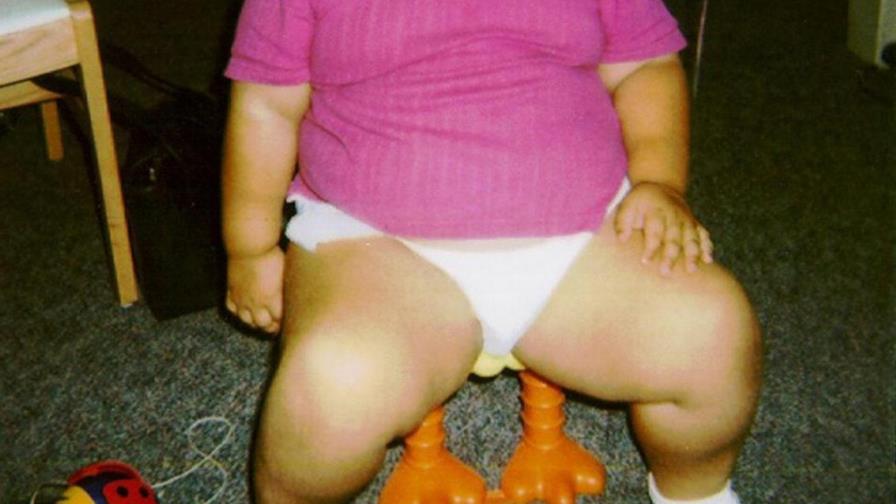 Estudio publica una ecuación que predice la obesidad infantil