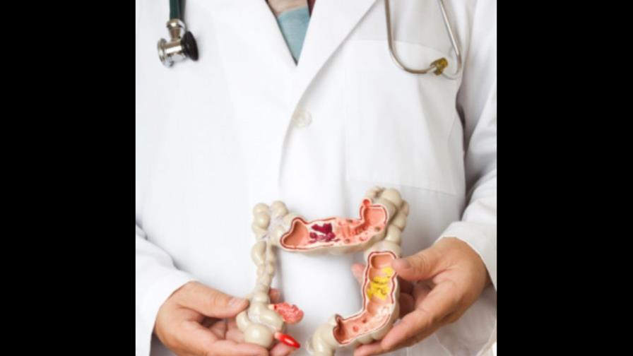 Los divertículos: una enfermedad de la civilización