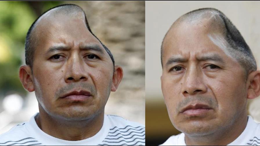 Guatemalteco golpeado en la cabeza por guardia gana demanda por US$58MM