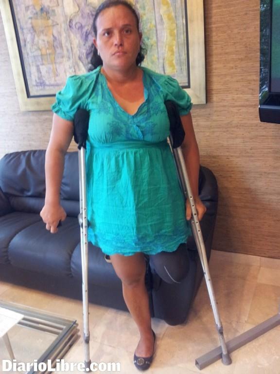 Mujer con una pierna amputada pide ayuda para una prótesis
