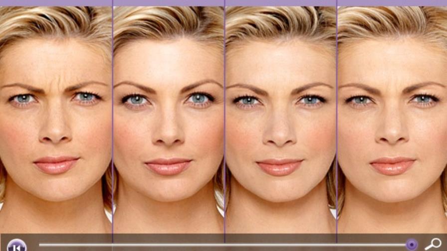 EE.UU. aprueba el botox para las patas de gallo