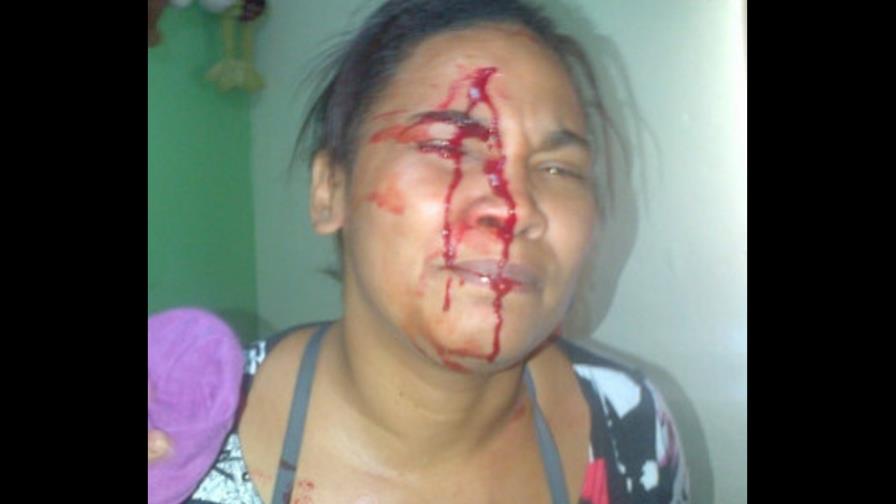 Agentes de la DNCD hieren varias personas durante operativo en Capotillo Agentes de la DNCD hieren varias personas durante operativo en Capotillo