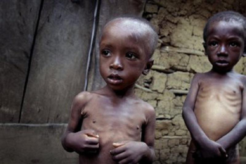 Unicef celebra progresos reales en la lucha contra la desnutrición infantil