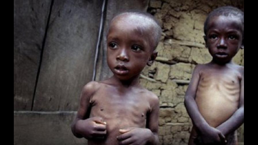 Unicef celebra progresos reales en la lucha contra la desnutrición infantil