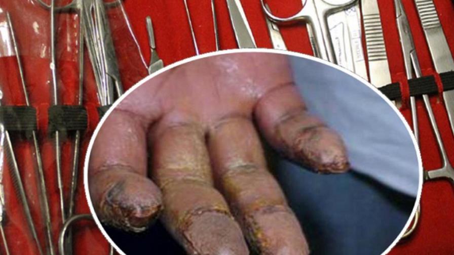 Médico dominicano confiesa borró huellas dactilares a 55 criminales en Massachusetts Médico dominicano confiesa borró huellas dactilares a 55 criminales en Massachusetts