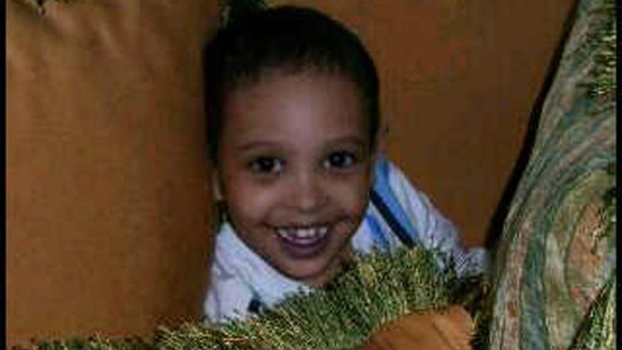 Madre solicita ayuda para cirugía de hijo