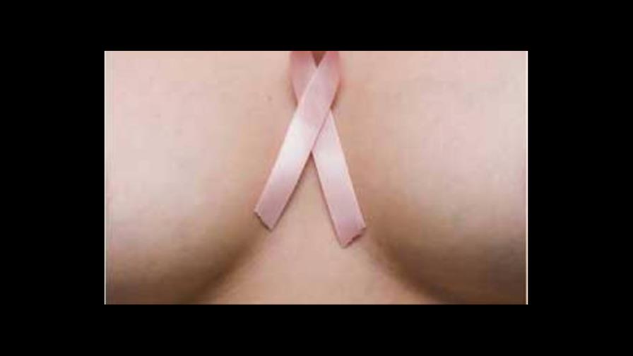 Consumir alimentos orgánicos no reduce el riesgo de cáncer en mujeres