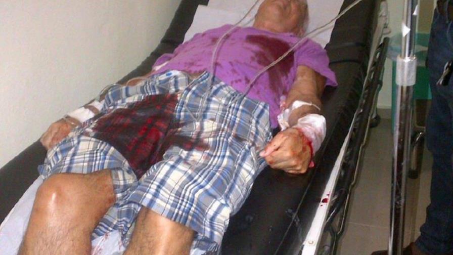 Apuñalan a dos turistas italianos en un hotel de Boca Chica