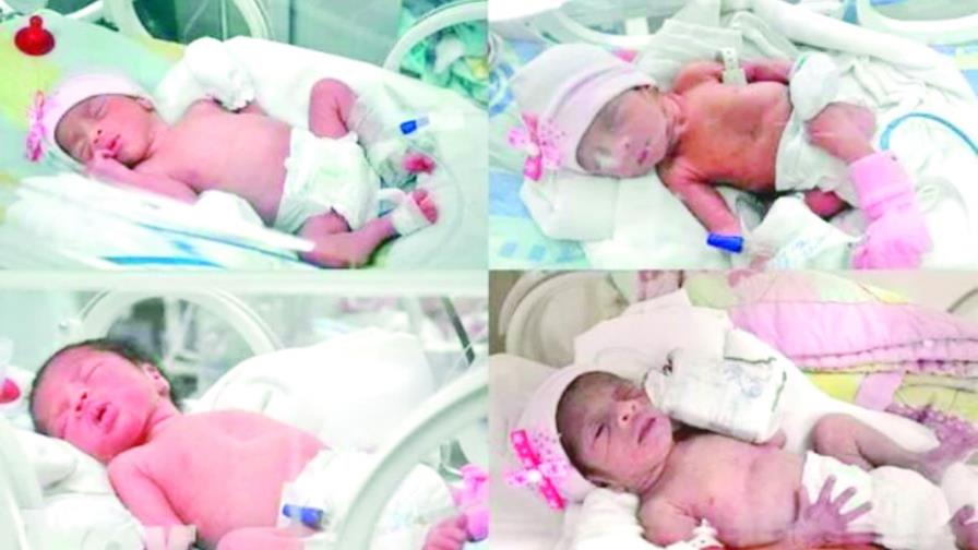 Una mujer alumbra cuatrillizas