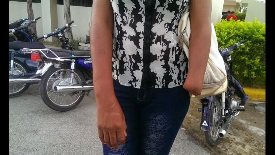 Envían a prisión hombre que mutiló brazo a ex concubina