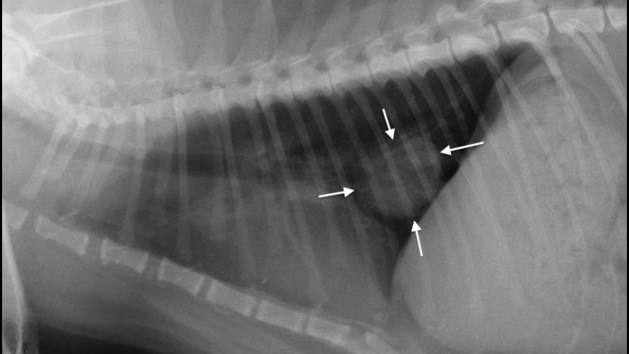 Otra razón para dejar de fumar Otra razón para dejar de fumar