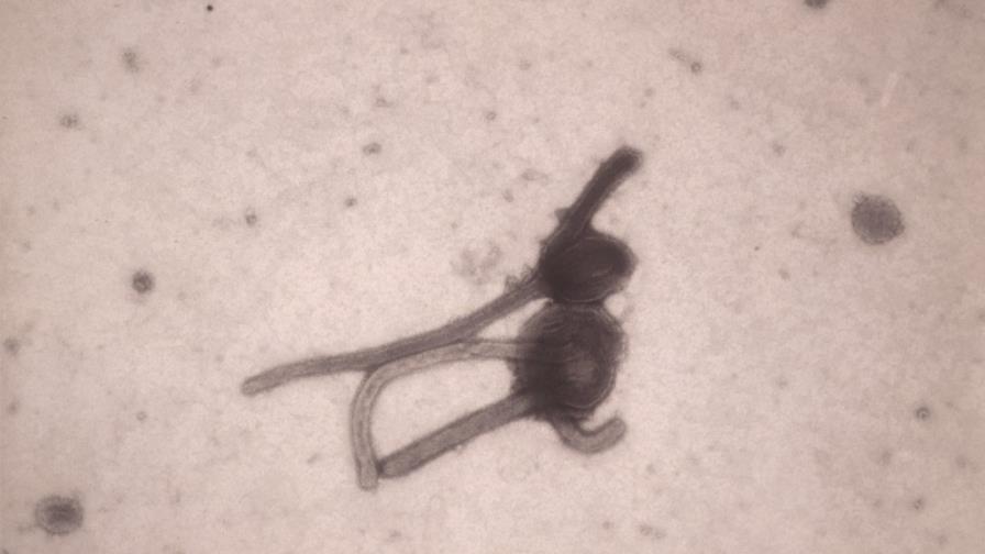 Descubren cómo el virus del ébola inhabilita el sistema de inmunidad