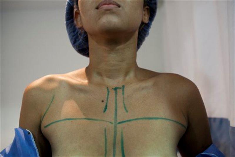 En Venezuela también escasean implantes de seno