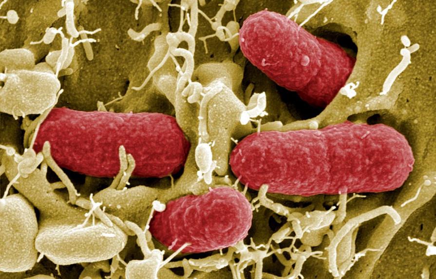 Estados Unidos contra bacterias resistentes a antibióticos