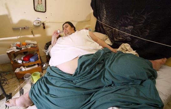 Murió en México quien fue el hombre más obeso del mundo