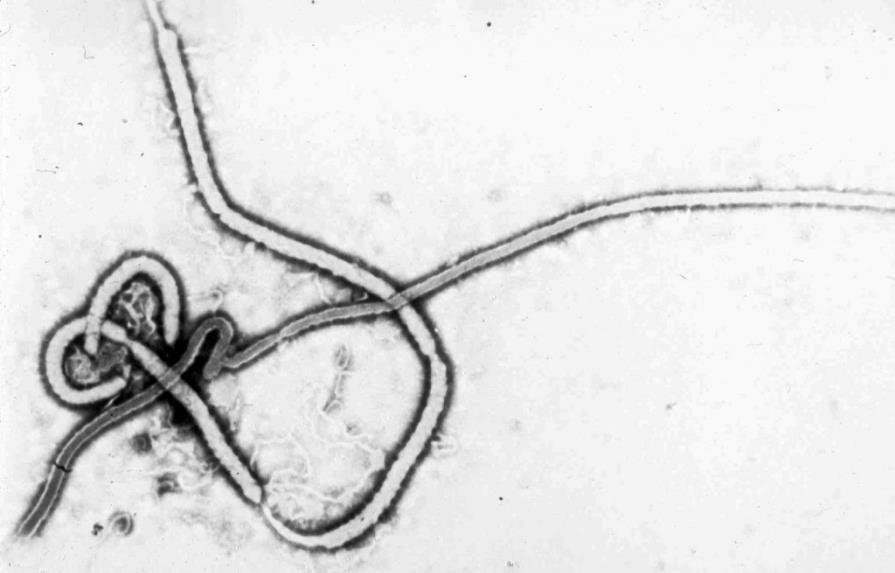 Sobrevivientes de ébola pueden transmitirlo por vía sexual