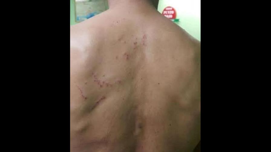 Denuncian policías de La Vega torturan a un detenido Denuncian policías de La Vega torturan a un detenido