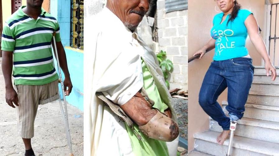 When the body needs a prosthetic device