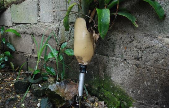 El gimnasta con pierna de “robot”