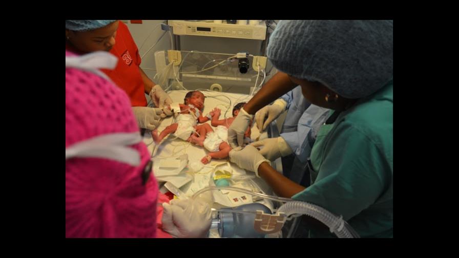Sextuplets born in Villa Mella hospital Sextuplets born in Villa Mella hospital
