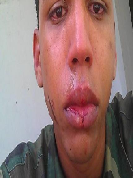 Raso del Ejército denuncia que fue golpeado por orden de un coronel