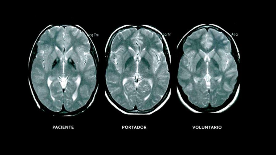 Rare diseases: when your case is one among thousands Rare diseases: when your case is one among thousands