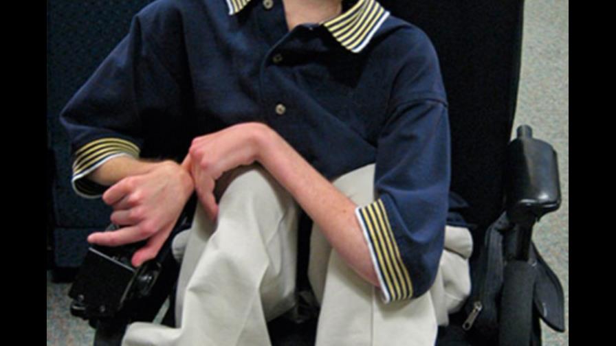 Japón busca tratamientos para distrofia muscular Japón busca tratamientos para distrofia muscular